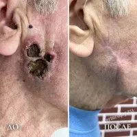 Всего лишь прыщик Всего лишь прыщик